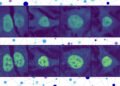 With AI, researchers predict the location of virtually any protein within a human cell | MIT News