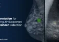 Mammogram Data Annotation for AI-Driven Breast Cancer Detection