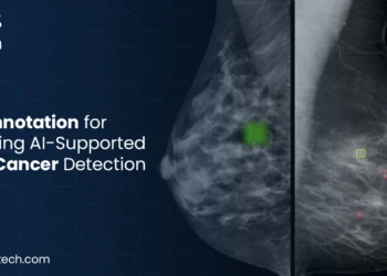 Mammogram Data Annotation for AI-Driven Breast Cancer Detection