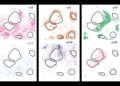 New AI system uncovers hidden cell subtypes, boosts precision medicine | MIT News