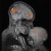 MIT’s McGovern Institute is shaping brain science and improving human lives on a global scale | MIT News