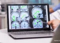 Top 6 Medical Image Annotation Tools in 2025