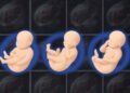 Machine-learning tool gives doctors a more detailed 3D picture of fetal health | MIT News