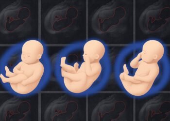 Machine-learning tool gives doctors a more detailed 3D picture of fetal health | MIT News