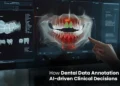 How Dental Data Annotation Powers AI-driven Clinical Decisions