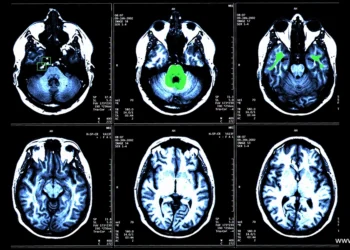 Quality Data Annotation for Cardiovascular AI