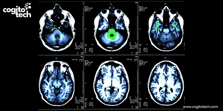 Quality Data Annotation for Cardiovascular AI