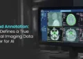 Medical Imaging Data Annotation for AI: Choosing the Right Partner