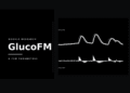 Google Research Introduces GlucoFM: A 0.72M-Parameter Dual-Stream Foundation Model for Continuous Glucose Monitoring